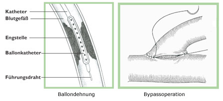 Platzhalter